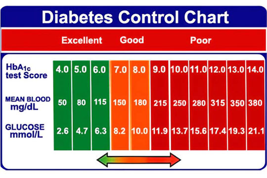 Understanding Diabetes chart Wall Chart 